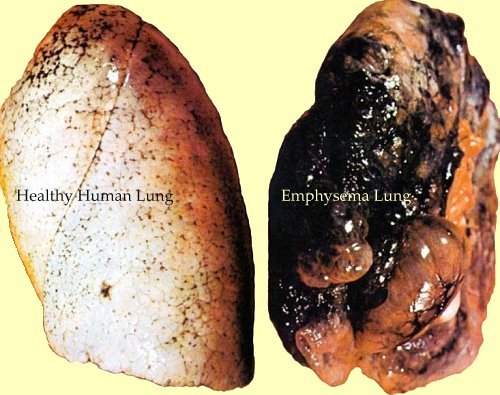 Health Notice: The Dangers on The Use of Tobacco (photos inside)