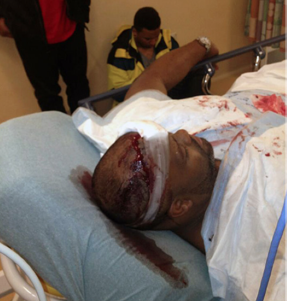 Shocking!! Photo Just Released of One of the Victims of the Chris Brown/Drake Club Brawl (WARNING GRAPHIC IMAGE)