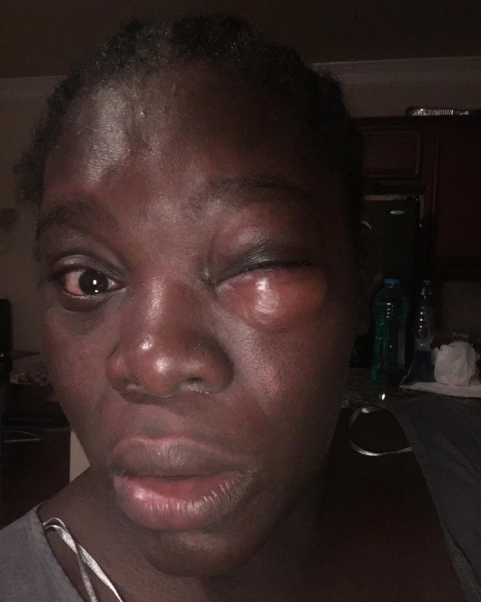 Image of Harisat Fatai after allegedly being assaulted by her then husband