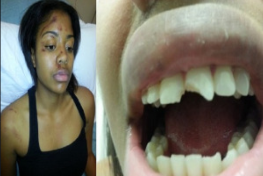 Jesse Jackson to Spearhead Protest Rally Against Police Assault of Black Female in Chicago (crime photo inside)