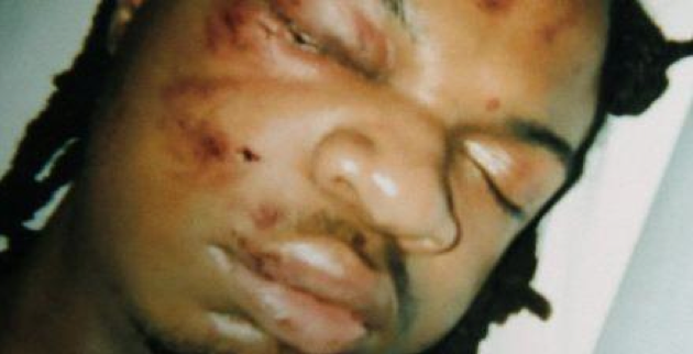 Where’s the Justice? Cops Chase, Beat Unarmed Honor Student Half to Death, and then are Acquitted (warning graphic image)